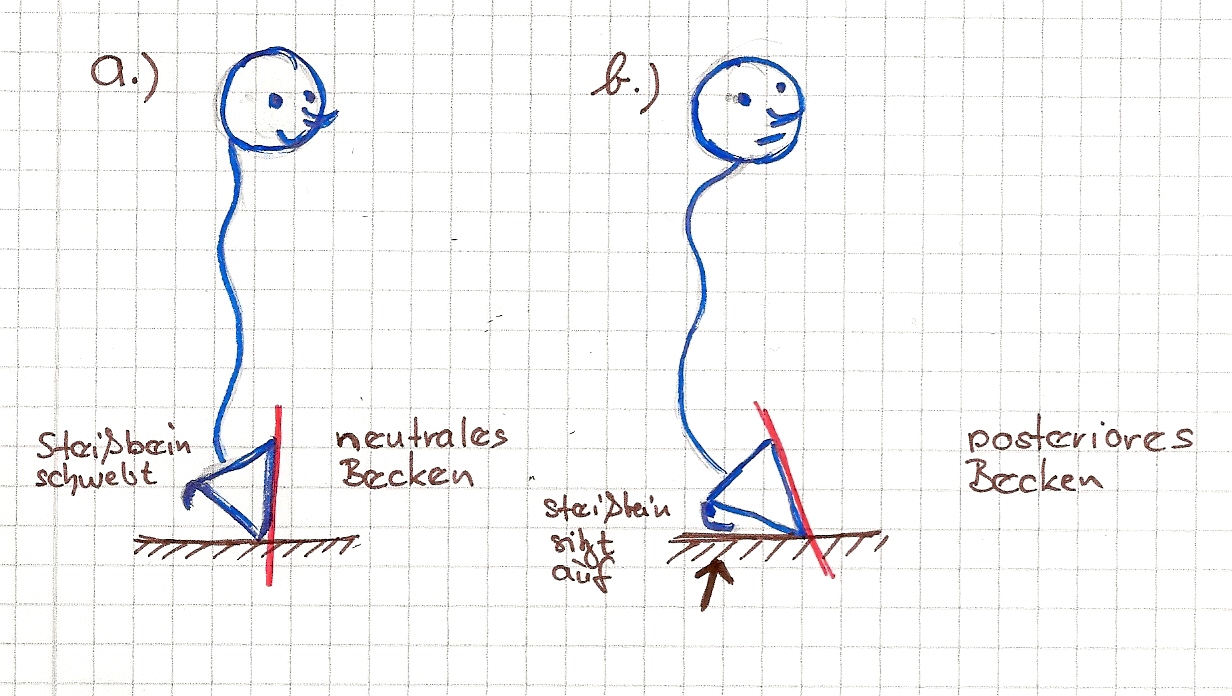 beckenstellung skizze 