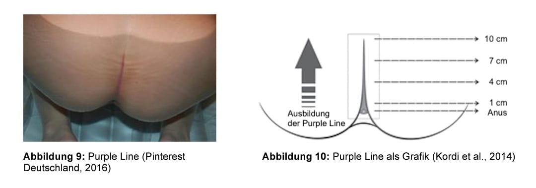 geburtsfortschritt purple line pinterest deutschland 2016
